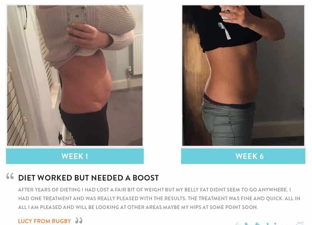 Before and After Dieting Greater London (Hackney)