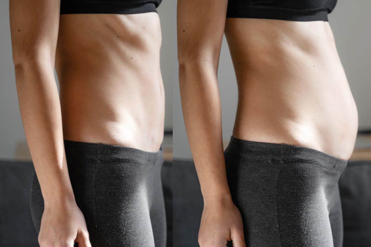 How long does diastasis recti take to improve Greater London (Hackney)?