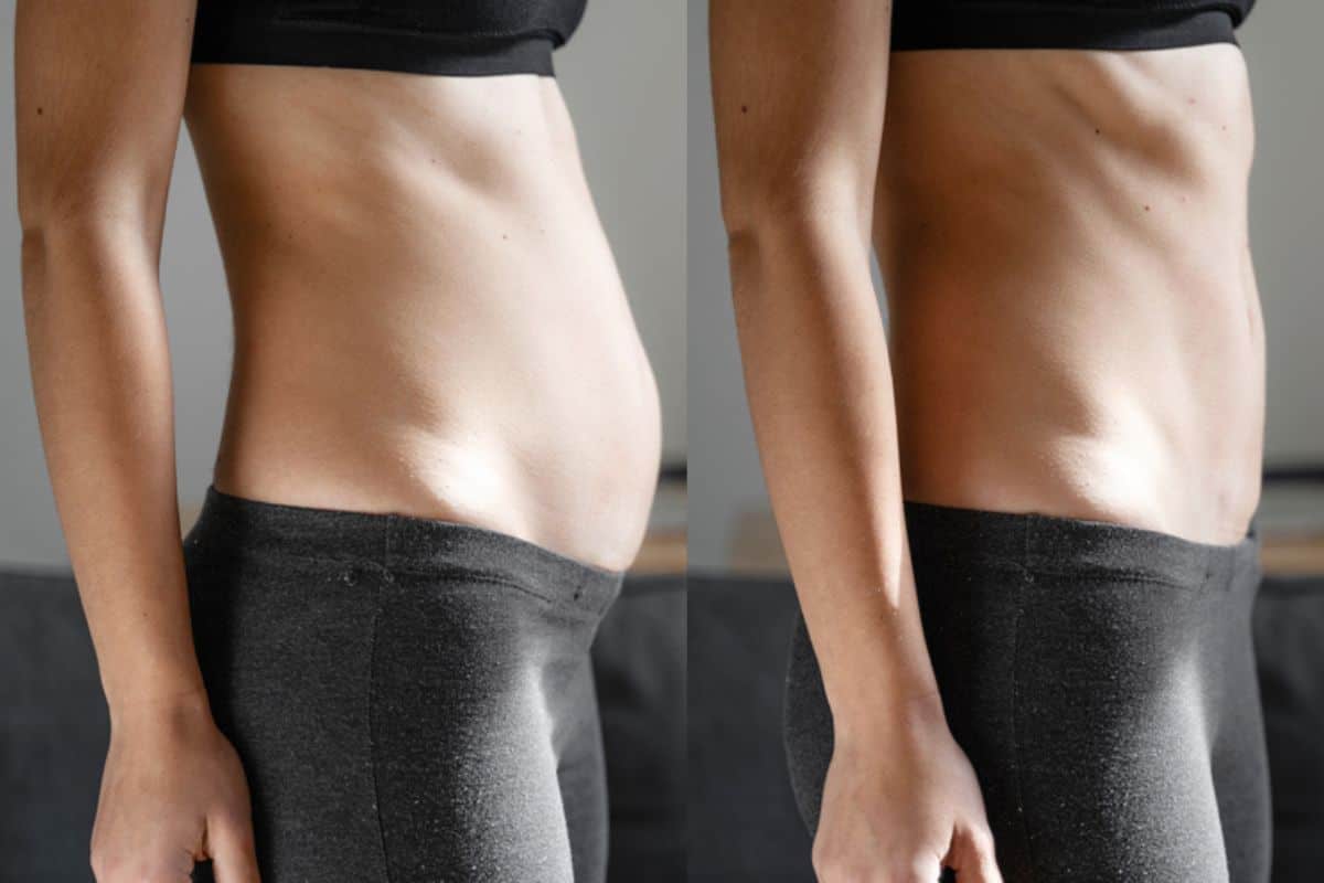 Post-Pregnancy: What Happens to Your Abdominal Muscles After Birth Greater London (Hackney)