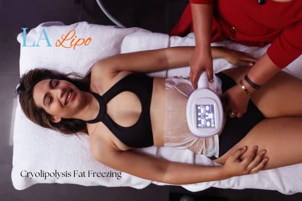 woman getting cryolipolysis Greater London (Hackney)