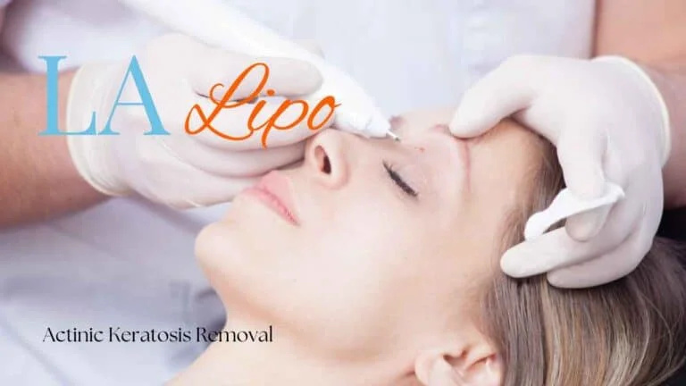 Woman receiving Actinic Keratosis Removal Treatment Greater London (Hackney)
