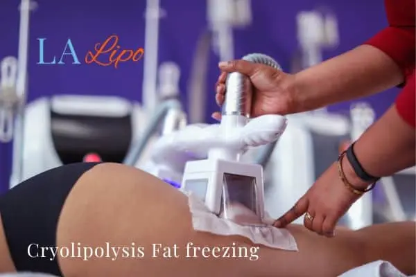 women getting fat freezing Greater London (Hackney)