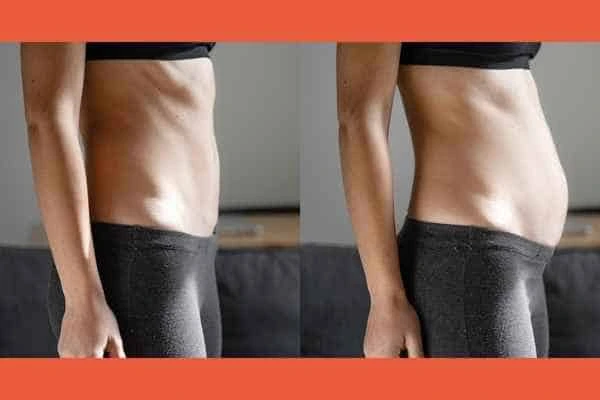 LA-EMS Body Sculpting results Greater London (Hackney)