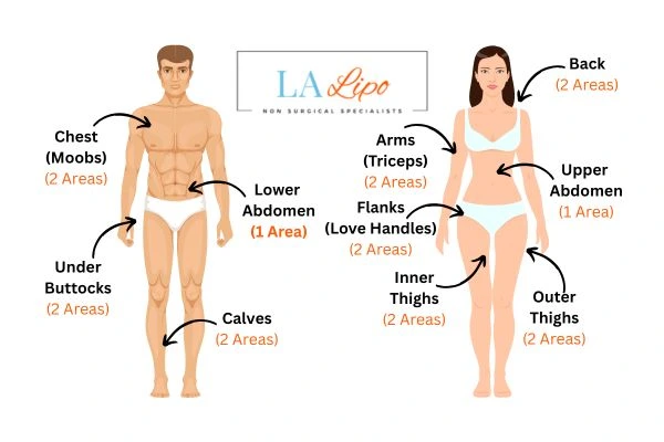 LA LIPO Cryolipolysis Areas Greater London (Hackney)