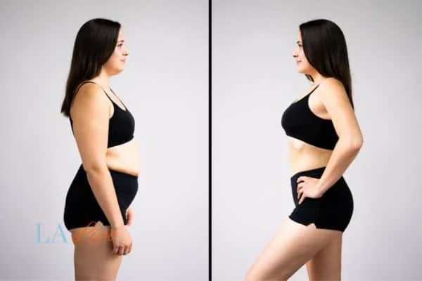 link between body image and mental health Greater London (Hackney)