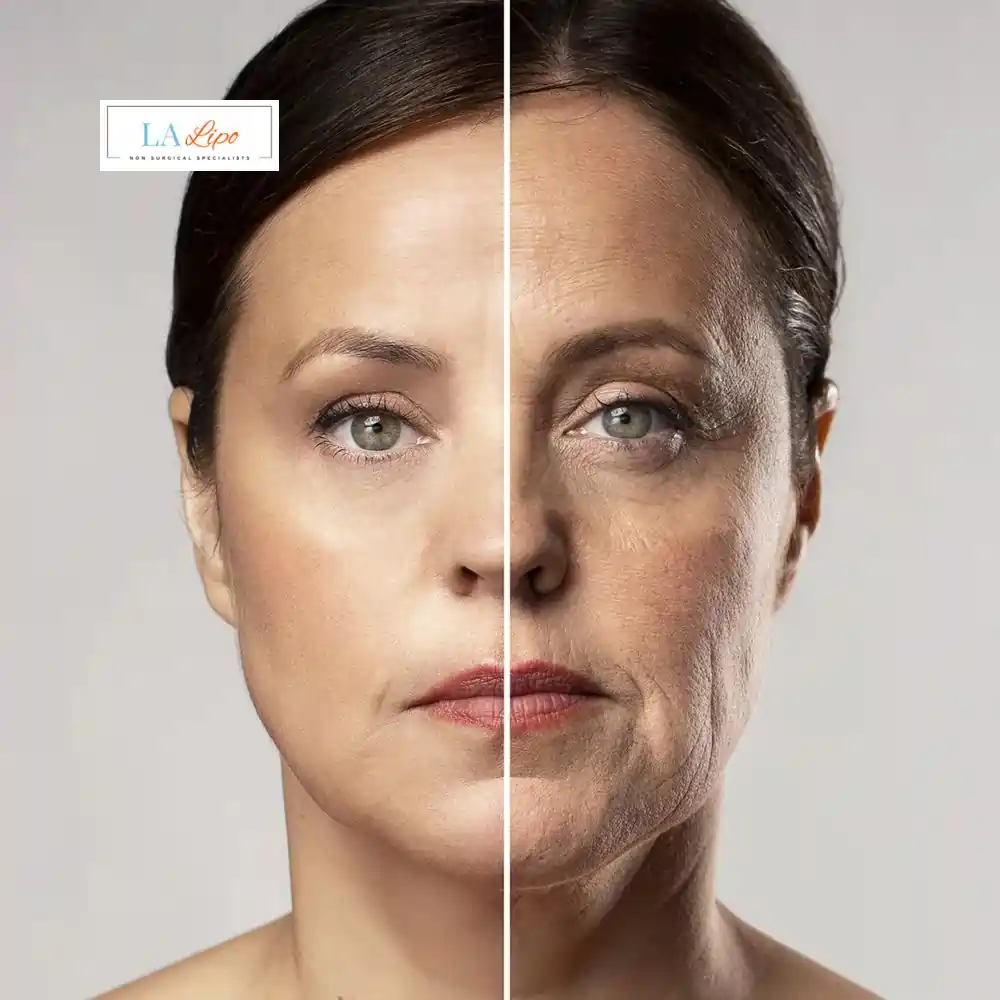 How Can You Tell If Non-Surgical Skin Tightening Is Right for You Greater London (Hackney)?