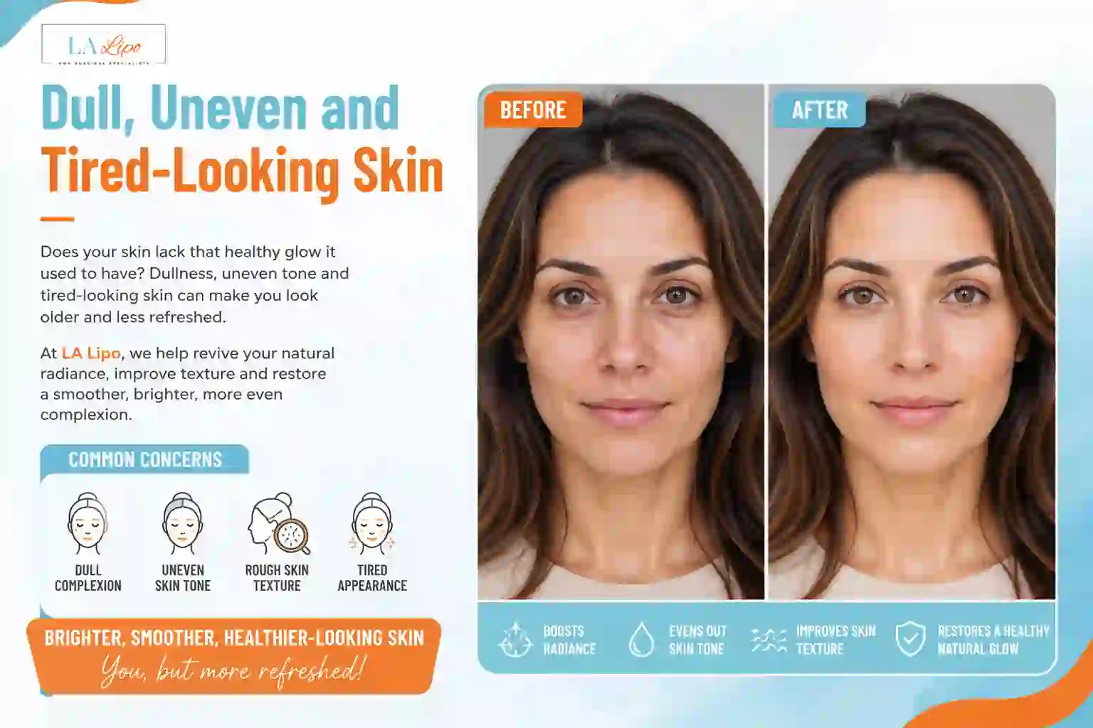 Sign #5: Dull, Uneven and Tired-Looking Skin Greater London (Hackney)