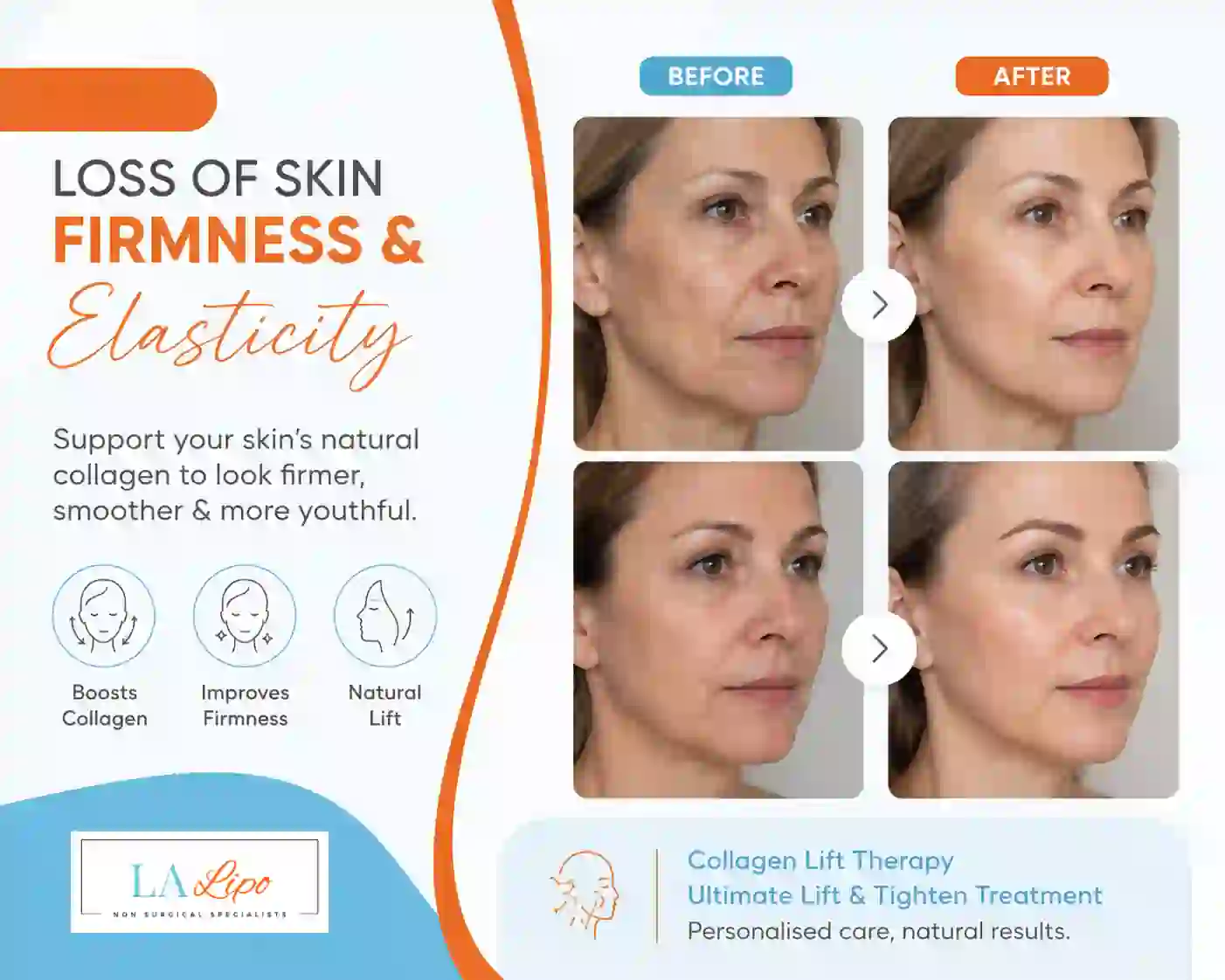 Sign #7: Loss of Skin Firmness and Elasticity Greater London (Hackney)
